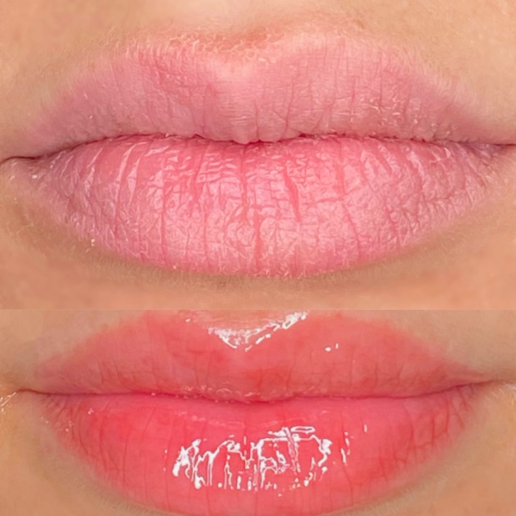 Lábios antes e depois do Hydra gloss